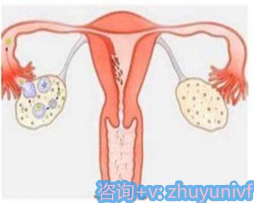 东莞捐卵代怀产后第一次来月经注意事项